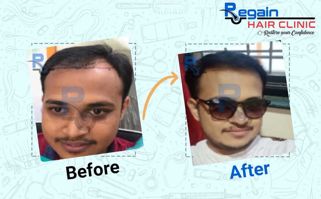 regain-success-stories-4